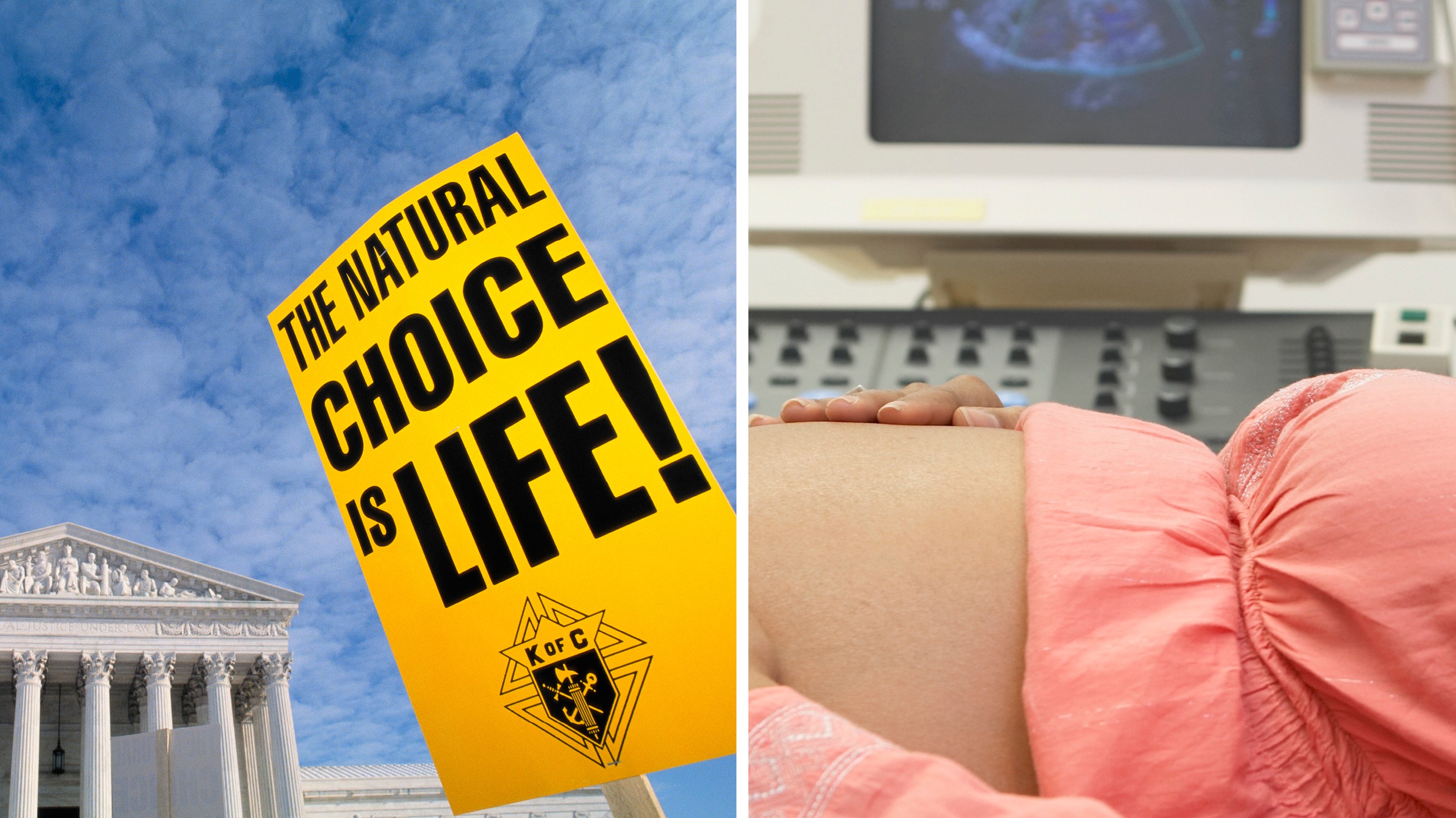 Crisis Pregnancy Centers V. Abortion Clinics – Brown Pelican Society Of ...